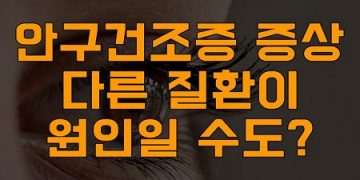 안구건조증 증상, 다른 질환이 원인일 수도