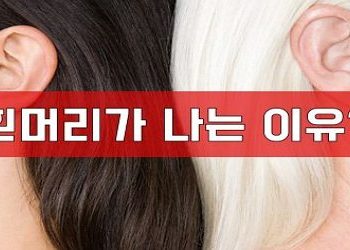 흰머리 나는 이유 흰머리 원인과 생기는 이유는 무엇일까