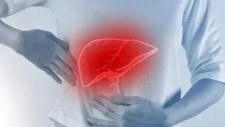 A형 간염 원인 및 증상 치료법