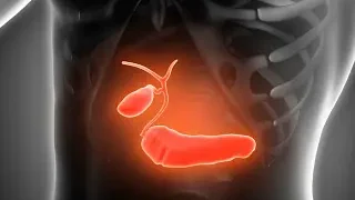 담도암의 증상과 진단 방법, 치료법은
