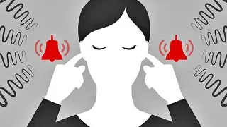 돌발성난청의 증상과 원인, 치료 및 예방법은