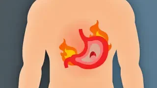 위염 증상과 위염에 좋은 음식, 필요한 생활습관은