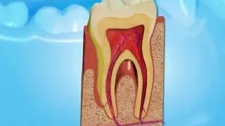 잇몸질환의 증상과 원인, 좋은 음식 Best 8