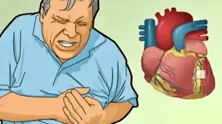 협심증의 종류와 초기증상, 진단 및 예방법은