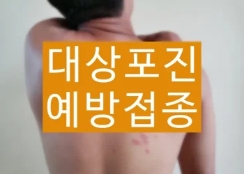 대상포진 예방접종 가격 무료 대상자 조회